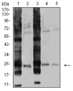 RalB Antibody (8A8A9) - BSA Free, Novus Biologicals 0.025 mL; Unconjugated:Antibodies,